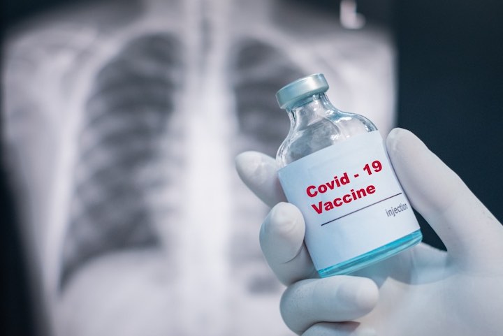 Coronavirus volontari sperimentazione vaccino covid 19